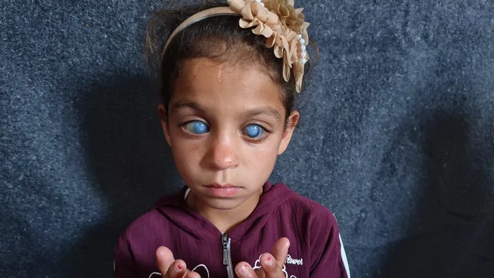 Little Sundus Needs Your Help to See the World Again